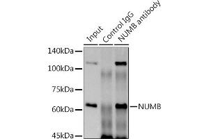 anti-Numb Homolog (NUMB) antibody