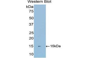 Western Blotting (WB) image for anti-Cadherin 1, Type 1, E-Cadherin (Epithelial) (CDH1) (AA 153-264) antibody (ABIN1077885)