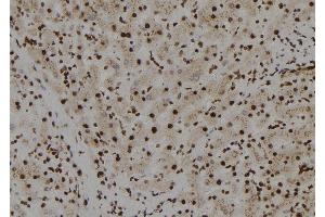 ABIN6272558 at 1/100 staining Human liver tissue by IHC-P. (TFCP2L1 anticorps  (N-Term))