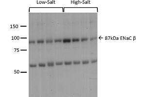 Western blot analysis of Mouse kidney cortex showing detection of ENaC protein using Rabbit Anti-ENaC Polyclonal Antibody (ABIN863203).