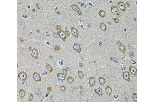 Immunohistochemistry of paraffin-embedded Rat brain using PDE1B Polyclonal Antibody at dilution of 1:100 (40x lens).