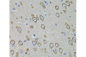 Immunohistochemistry of paraffin-embedded Rat brain using PDE1B Polyclonal Antibody at dilution of 1:100 (40x lens). (PDE1B anticorps)
