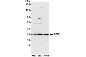 anti-Processing of Precursor 4, Ribonuclease P/MRP Subunit (POP4) (AA 170-220) antibody