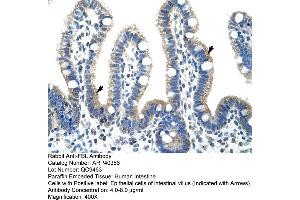 Rabbit Anti-FBL Antibody  Paraffin Embedded Tissue: Human Intestine Cellular Data: Epithelial cells of intestinal villas Antibody Concentration: 4.