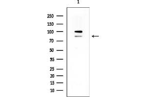 anti-TBC1 Domain Family, Member 12 (TBC1D12) antibody