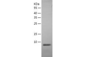 Western Blotting (WB) image for Epidermal Growth Factor (EGF) (AA 977-1029) protein (His-IF2DI Tag) (ABIN7122800) (EGF Protein (AA 977-1029) (His-IF2DI Tag))