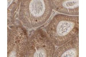 Immunohistochemical analysis of SPINK2 in mouse testis tissue with SPINK2 polyclonal antibody  at 2. (SPINK2 anticorps  (C-Term))