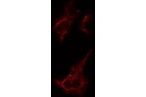 ABIN6274386 staining Hela cells by IF/ICC. (AAK1 anticorps  (Internal Region))