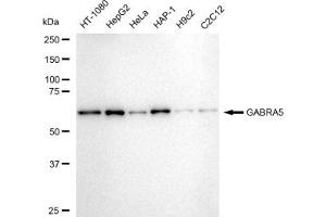 Western blotting analysis using GABRA5 antibody (ABIN7798689).
