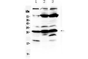 Western blot analysis of RanBP1 using anti- RanBP1 antibody . (RANBP1 anticorps  (AA 2-201))