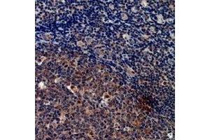 Immunohistochemical analysis of Cystatin A staining in human tonsil formalin fixed paraffin embedded tissue section. (CSTA anticorps  (C-Term))