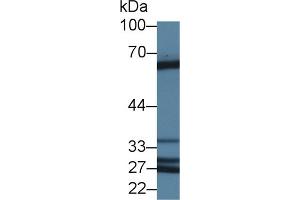 Detection of ABI1 in Human Lung lysate using Polyclonal Antibody to Abl Interactor 1 (ABI1)