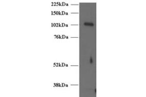 Western Blotting (WB) image for anti-Unc-13 Homolog D (UNC13D) (C-Term) antibody (ABIN2466418) (UNC13D anticorps  (C-Term))