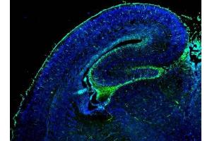 IHC-Fr Image GFAP antibody detects GFAP protein on embryonic mouse brain by immunohistochemical analysis. (GFAP anticorps)