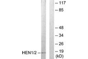 Western blot analysis of extracts from Jurkat cells, using HEN1/2 Antibody. (HEN1/2 (AA 41-90) anticorps)
