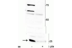 Western blot of mouse heart lysate showing specific immunolabeling of ~25 kDa cardiac troponin I protein phosphorylated at Ser150 in the first lane (-). (TNNI3 anticorps  (pSer150))