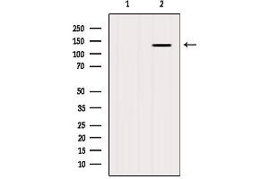 Western blot analysis of extracts from Mouse brain, using GHR Antibody. (Growth Hormone Receptor anticorps  (Internal Region))