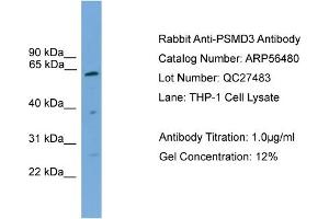 WB Suggested Anti-PSMD3  Antibody Titration: 0. (PSMD3 anticorps  (Middle Region))