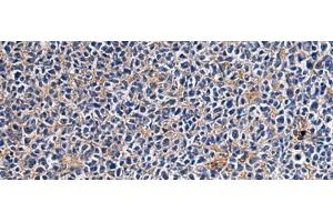 Immunohistochemistry of paraffin-embedded Human tonsil tissue using CEP89 Polyclonal Antibody at dilution of 1:95(x200) (CEP89 anticorps)