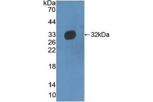 Western blot analysis of recombinant Human HPR. (HPR anticorps  (AA 102-347))