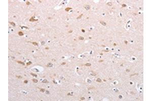 The image on the left is immunohistochemistry of paraffin-embedded Human brain tissue using ABIN7130592(PFN4 Antibody) at dilution 1/20, on the right is treated with fusion protein.