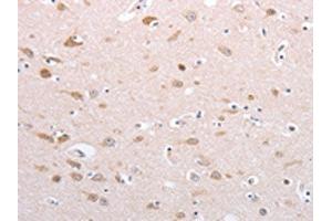 The image on the left is immunohistochemistry of paraffin-embedded Human brain tissue using ABIN7130592(PFN4 Antibody) at dilution 1/20, on the right is treated with fusion protein. (Profilin 4 anticorps)