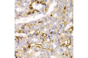 Immunohistochemistry of paraffin-embedded rat kidney using Neurofilament L antibody (ABIN3020808, ABIN3020809, ABIN3020810 and ABIN6213733) at dilution of 1:200 (40x lens). (NEFL anticorps  (AA 400-543))