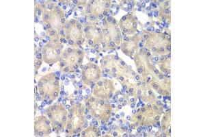 Immunohistochemistry of paraffin-embedded rat kidney using  antibody (ABIN6127428, ABIN6136509, ABIN6136511 and ABIN6217463) at dilution of 1:100 (40x lens). (Aminoacylase 1 anticorps  (AA 1-408))