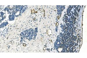 IHC analysis of H Cadherin/CDH13 using anti-H Cadherin/CDH13 antibody (ABIN7600095).
