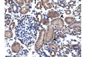 Human kidney (Bcl-2 anticorps  (N-Term))