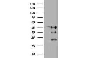 Image no. 1 for anti-Transmembrane Protein 173 (TMEM173) antibody (ABIN1501423) (STING/TMEM173 anticorps)