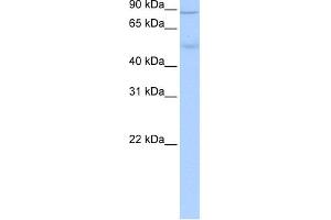 WB Suggested Anti-ALDH1L1 Antibody Titration: 0. (ALDH1L1 anticorps  (Middle Region))