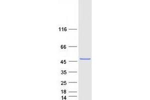 Validation with Western Blot