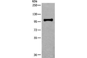 Western blot analysis of HEPG2 cell lysate using HELLS Polyclonal Antibody at dilution of 1:400 (HELLS anticorps)