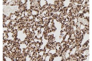 ABIN6261375 and ABIN6272996 at 1/100 staining Rat lung tissue by IHC-P.