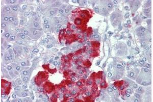 Pancreas, Human: Formalin-Fixed, Paraffin-Embedded (FFPE) (PDGF-BB Homodimer (AA 222-233) anticorps)