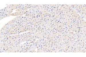 Detection of CALR in Human Cardiac Muscle Tissue using Polyclonal Antibody to Calreticulin (CALR)