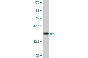 Western Blot detection against Immunogen (37. (GAPDH anticorps  (AA 226-335))