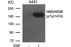 Western blot analysis of extracts from A431 cells untreated or treated with EGF using NMDAR2B (phospho-Tyr1474) Antibody. (GRIN2B anticorps  (pTyr1474))