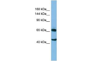 Host: Rabbit Target Name: CLASP2 Sample Type: HT1080 Whole cell lysates Antibody Dilution: 1.