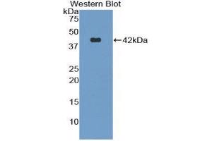 Western Blotting (WB) image for anti-Natriuretic Peptide Type C (NPPC) (AA 18-104) antibody (ABIN1858432) (NPPC anticorps  (AA 18-104))