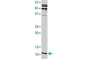 S100A16 polyclonal antibody . (S100A16 anticorps)