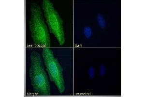 ABIN570771 Immunofluorescence analysis of paraformaldehyde fixed HeLa cells, permeabilized with 0. (COL4a6 anticorps  (Internal Region))
