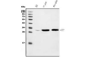 Western blot analysis of Carbonic Anhydrase I/CA1 using anti-Carbonic Anhydrase I/CA1 antibody (ABIN7602620).