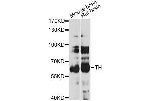 Western blot analysis of extracts of various cell lines, using TH antibody (ABIN5974878) at 1/1000 dilution. (TH anticorps)