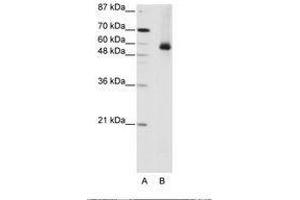 Image no. 2 for anti-Heterogeneous Nuclear Ribonucleoprotein L (HNRNPL) (AA 281-330) antibody (ABIN203218) (HNRNPL anticorps  (AA 281-330))