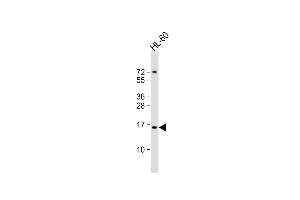 Anti-KISS1 Antibody (C-Term)at 1:2000 dilution + HL-60 whole cell lysates Lysates/proteins at 20 μg per lane.
