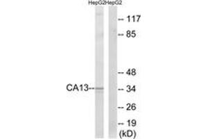 Western blot analysis of extracts from HepG2 cells, using CA13 Antibody. (CA13 anticorps  (AA 141-190))