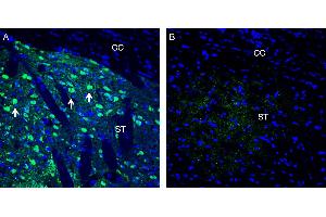Expression of Neuronal Pentraxin 1 in rat striatum. (Neuronal Pentraxin 1 (NPX1) Peptide)