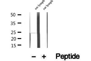 Western blot analysis of extracts of rat lymph tissue, using LAPTM4B antibody. (LAPTM4B anticorps  (Internal Region))